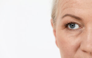 A close-up shot of a woman's under-eye wrinkles